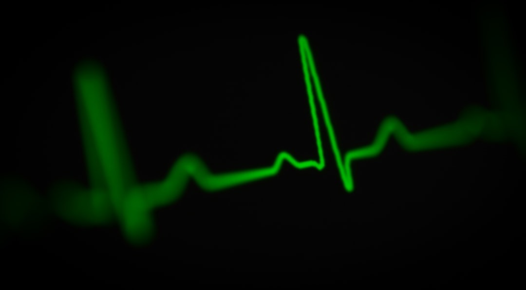 Come scegliere la fascia cardio migliore per la corsa